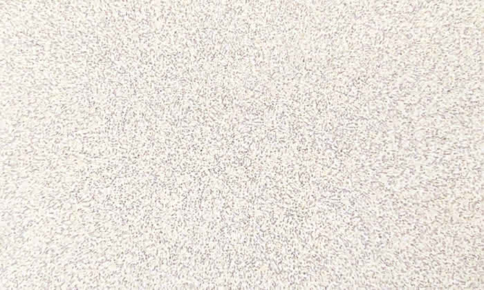 462499 #1